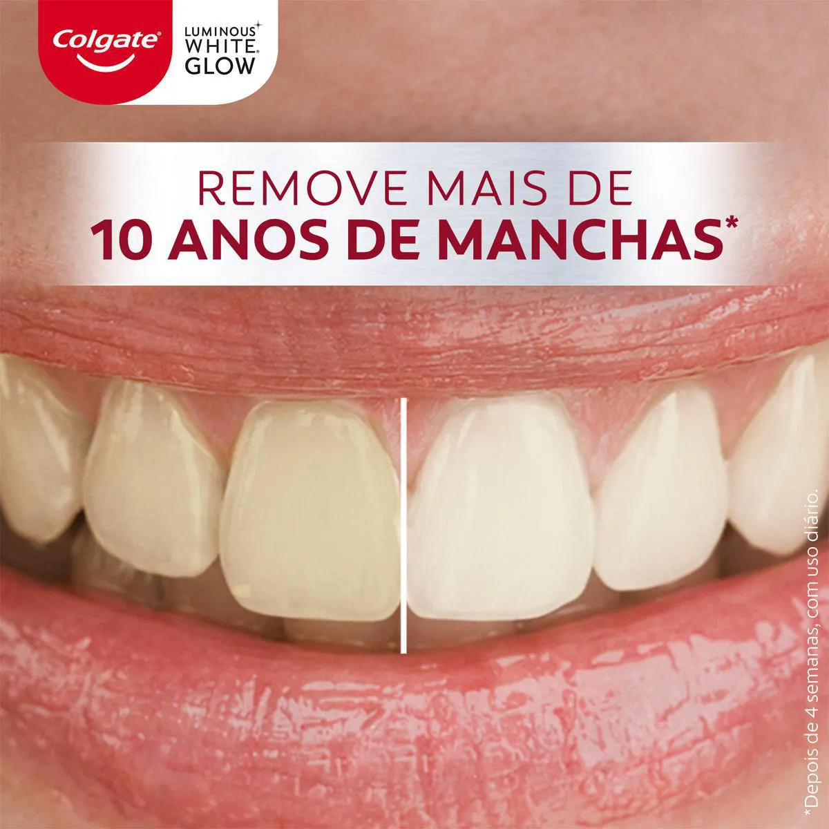Remove mais de 10 anos de manchas - Antes e depois